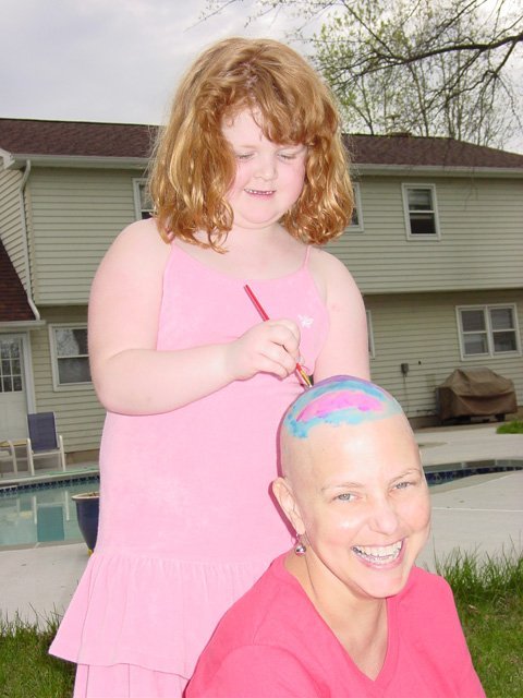 Bald and Beautiful